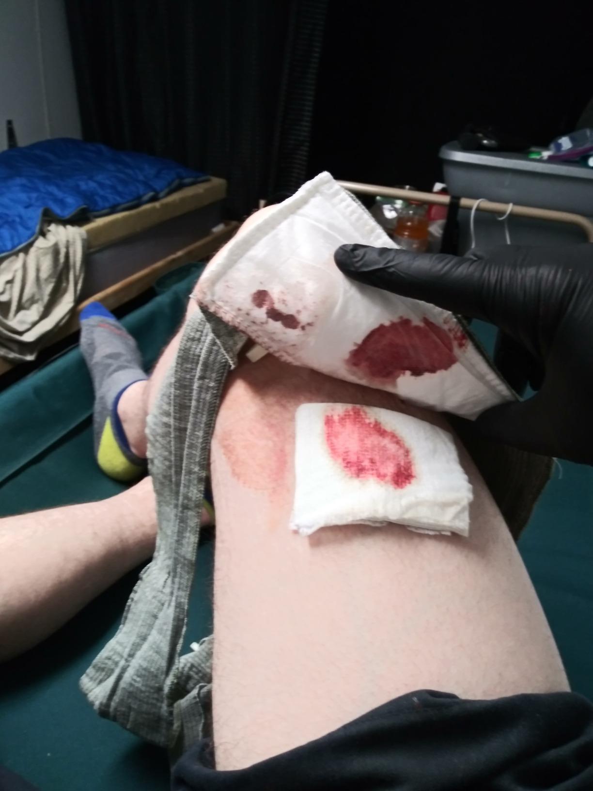 Lightning X Gunshot Trauma/Hemorrhage Control Kit in MOLLE IFAK Pouch - TAN customer photo 1