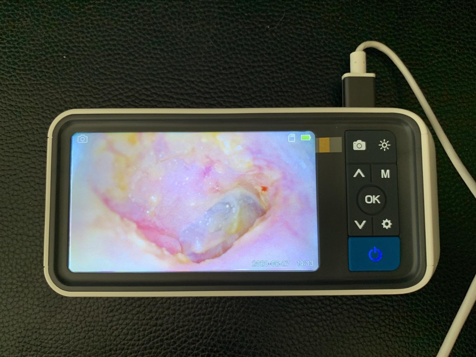 ScopeAround Otoscope with 4.5