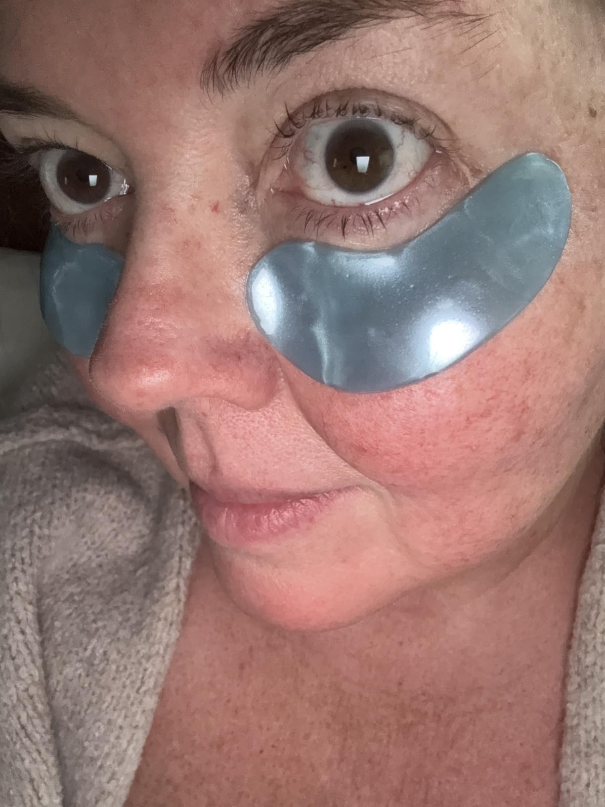 grace & stella Award Winning Under Eye Mask - Teen Gifts, Gel Eye Patches for Dark Circles, Puffy Eyes, Wrinkles, Undereye Bags, Travel Gifts for Women - Vegan, Self Care (6 Pairs, Gold) customer photo 1
