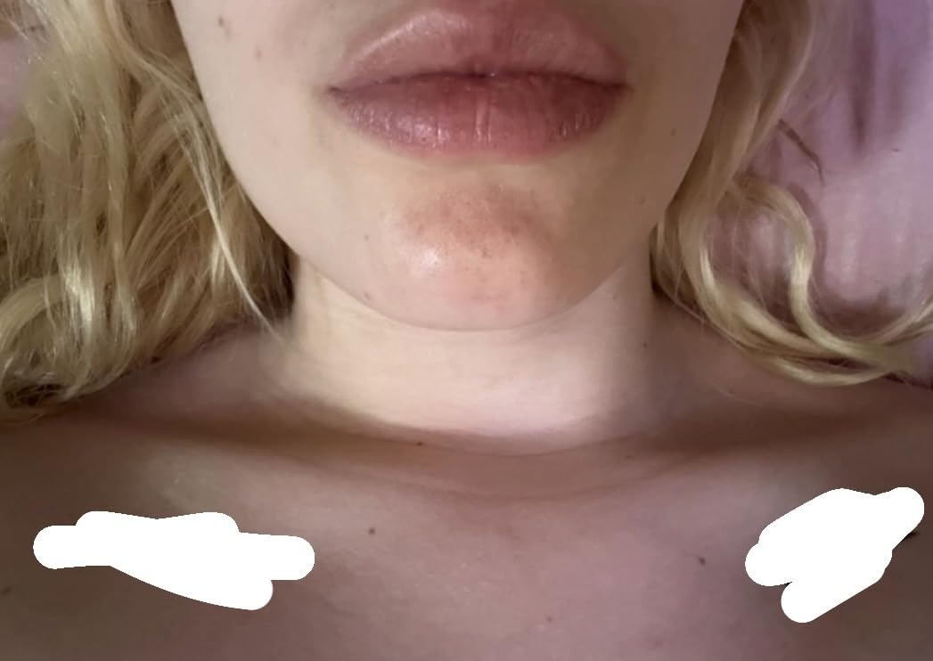 Paula's Choice SKIN PERFECTING 2% BHA Liquid Leave-On Exfoliant customer photo 2