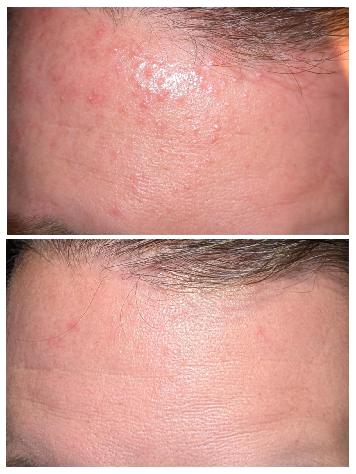 CeraVe Resurfacing Retinol Face Serum with Niacinamide, Pore Minimizer, 1oz customer photo 2