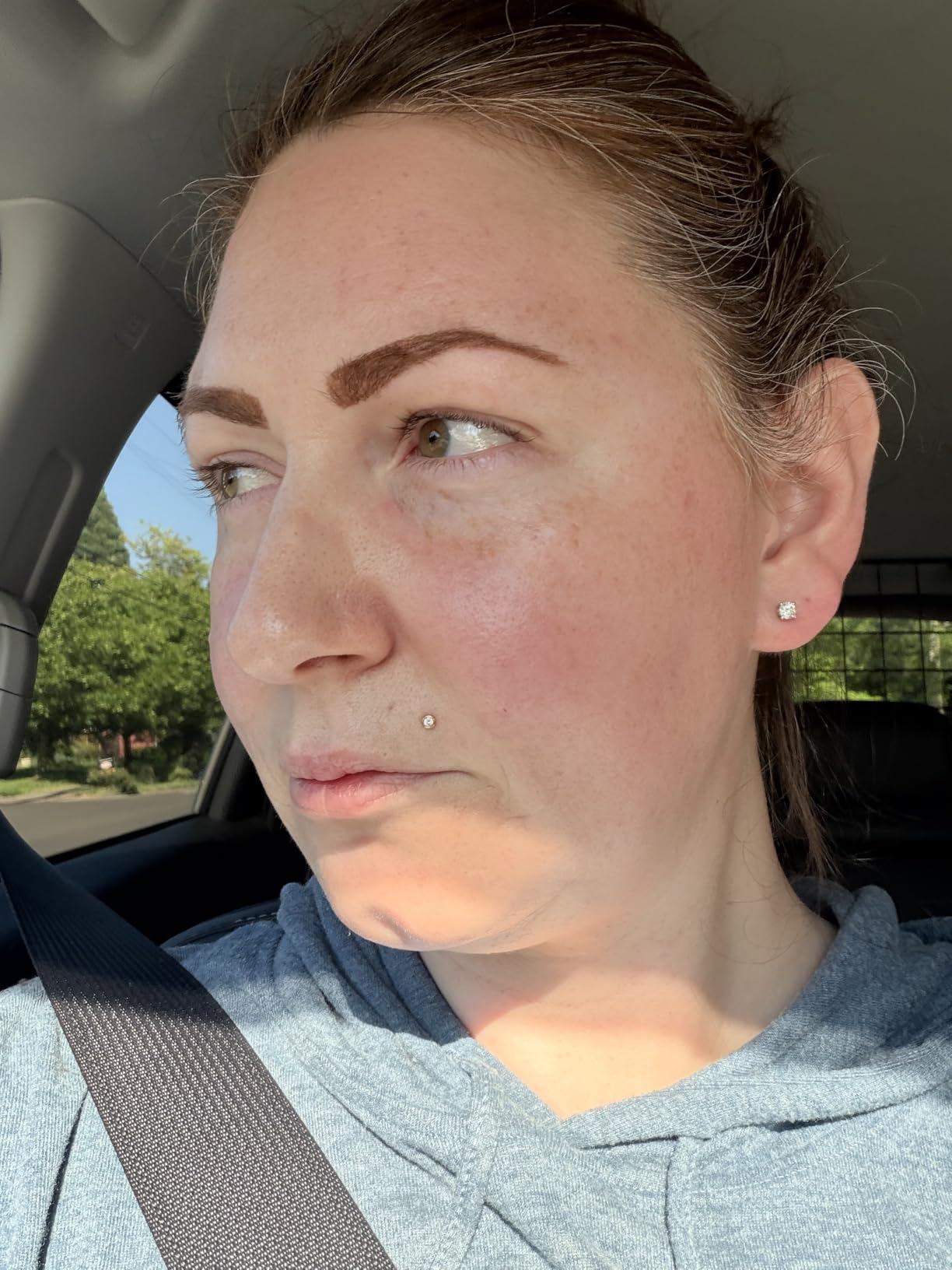 The Ordinary The Daily Set, Daily Skincare Routine with Squalane Cleanser, Hyaluronic Acid 2% + B5, and Natural Moisturizing Factors + HA | Skin Care Set customer photo 1