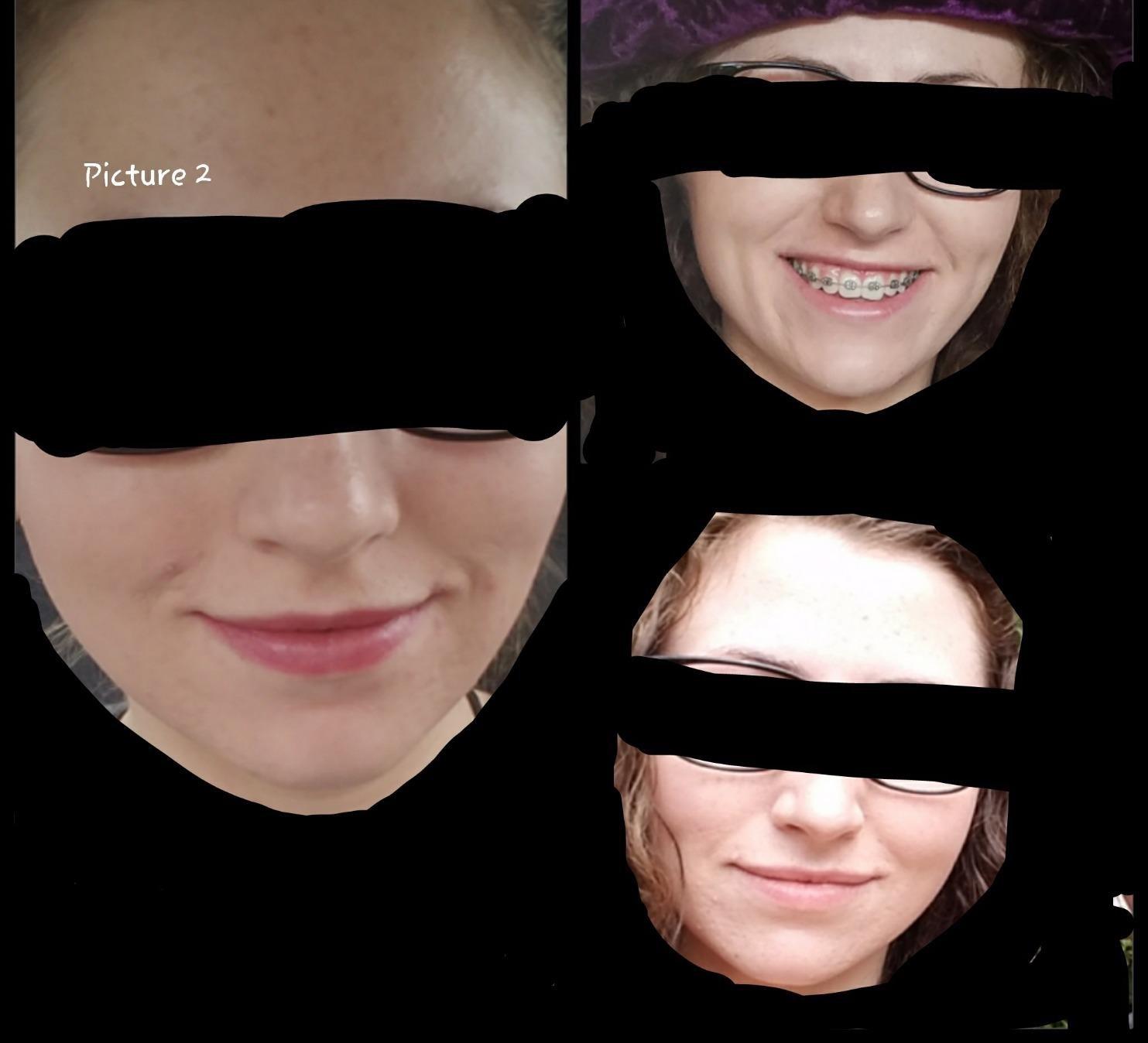 CeraVe Renewing Salicylic Acid Cleanser, Gentle Exfoliating Face Wash, 16oz customer photo 2