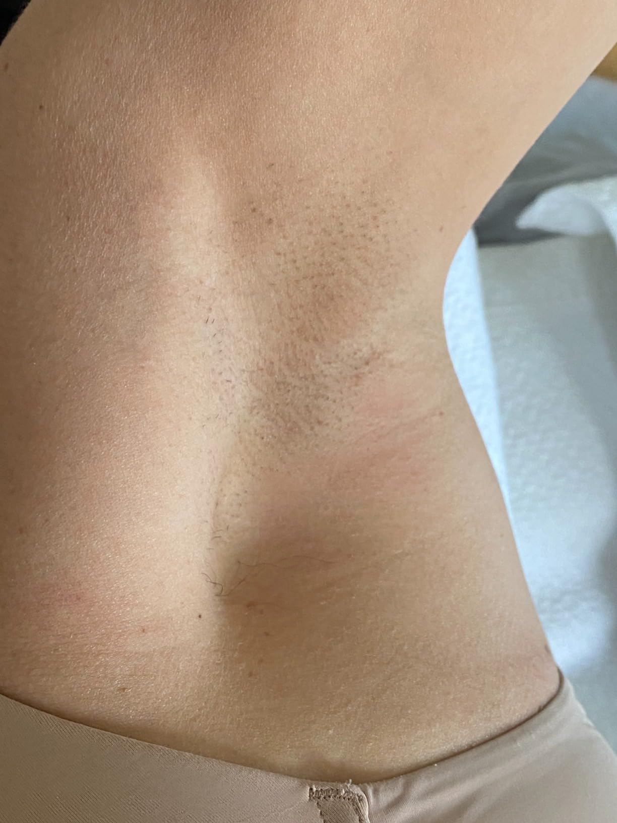 Braun IPL, Silk·Expert Pro 5, IPL Hair Removal for Women and Men, Permanent Laser Hair Reduction At-Home, 4 Heads, IPL5347 customer photo 1