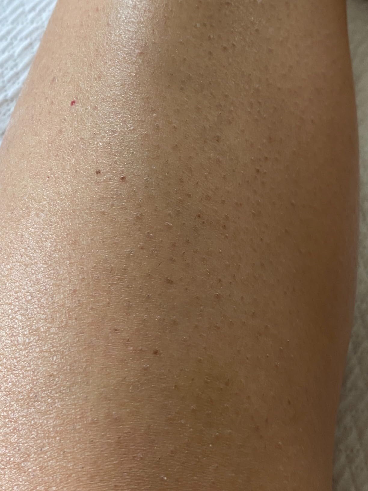 Braun IPL, Silk·Expert Pro 5, IPL Hair Removal for Women and Men, Permanent Laser Hair Reduction At-Home, 4 Heads, IPL5347 customer photo 2