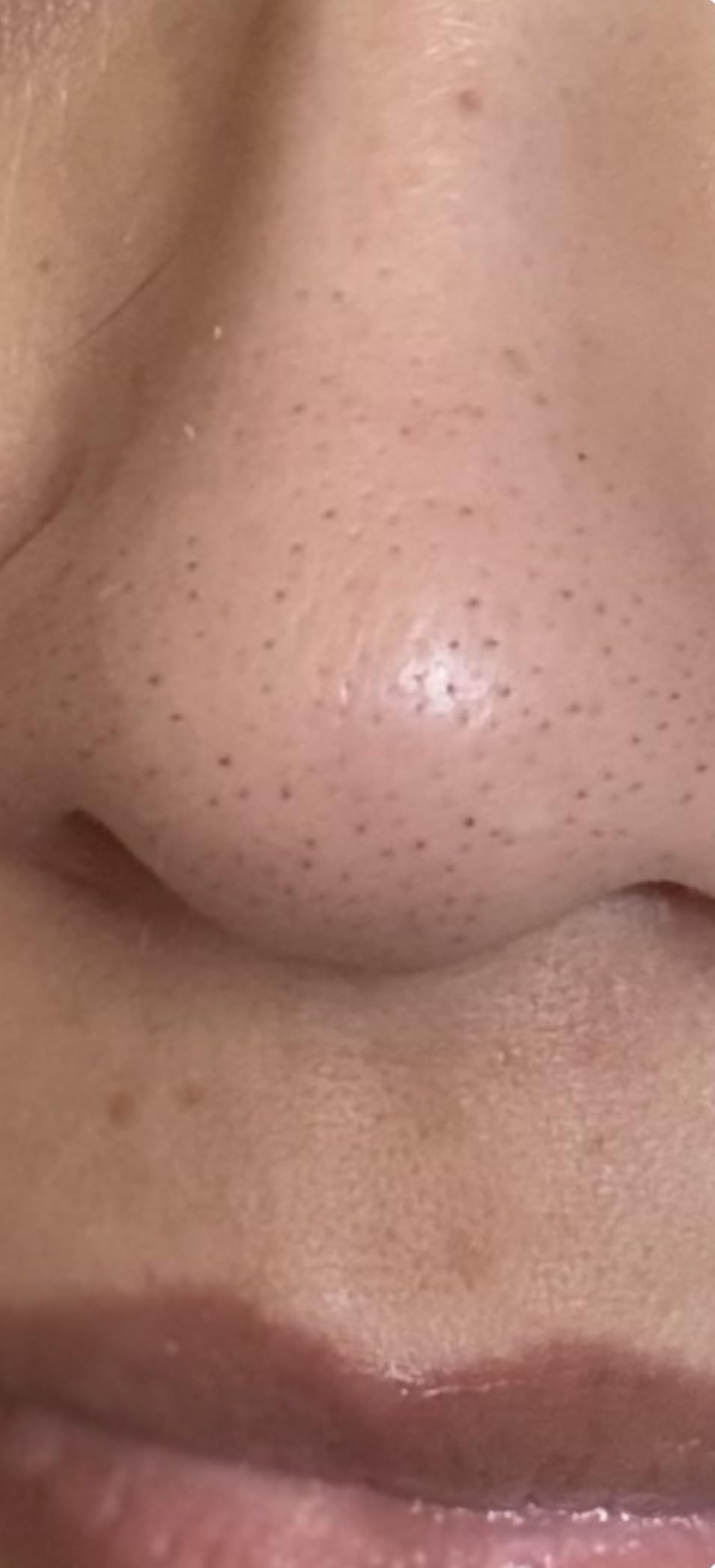 Hero Cosmetics Pore Release Blackhead Clearing Solution, 3.38 Fl Oz customer photo 2