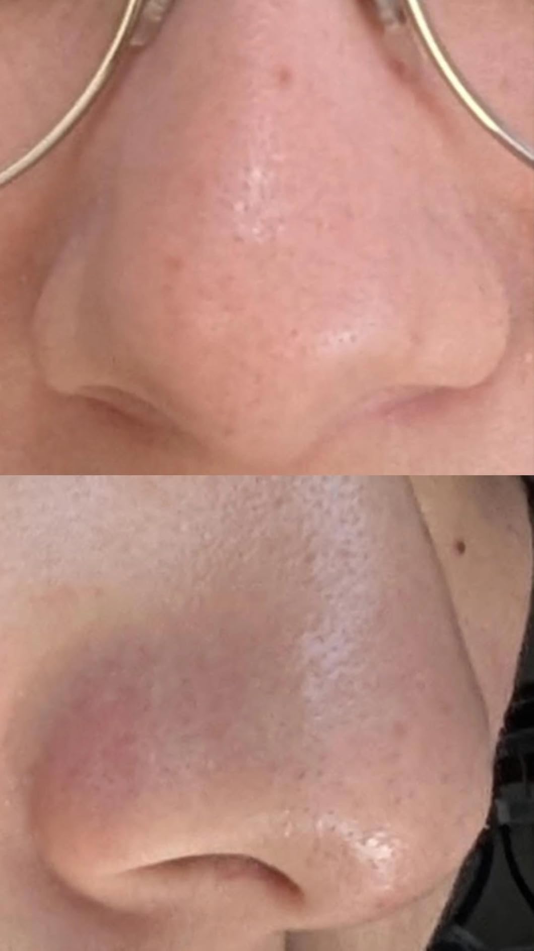 SKIN1004 [Hudson's Pick] Poremizing Clay Stick Mask, Pore Care, 0.95 oz customer photo 2