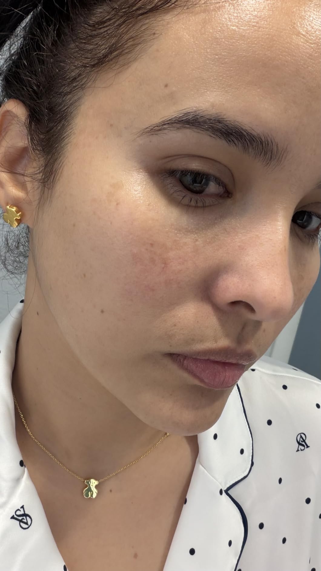 Anua Niacinamide 10 + TXA 4 Serum, Korean Skincare, 1.01 fl.oz customer photo 2