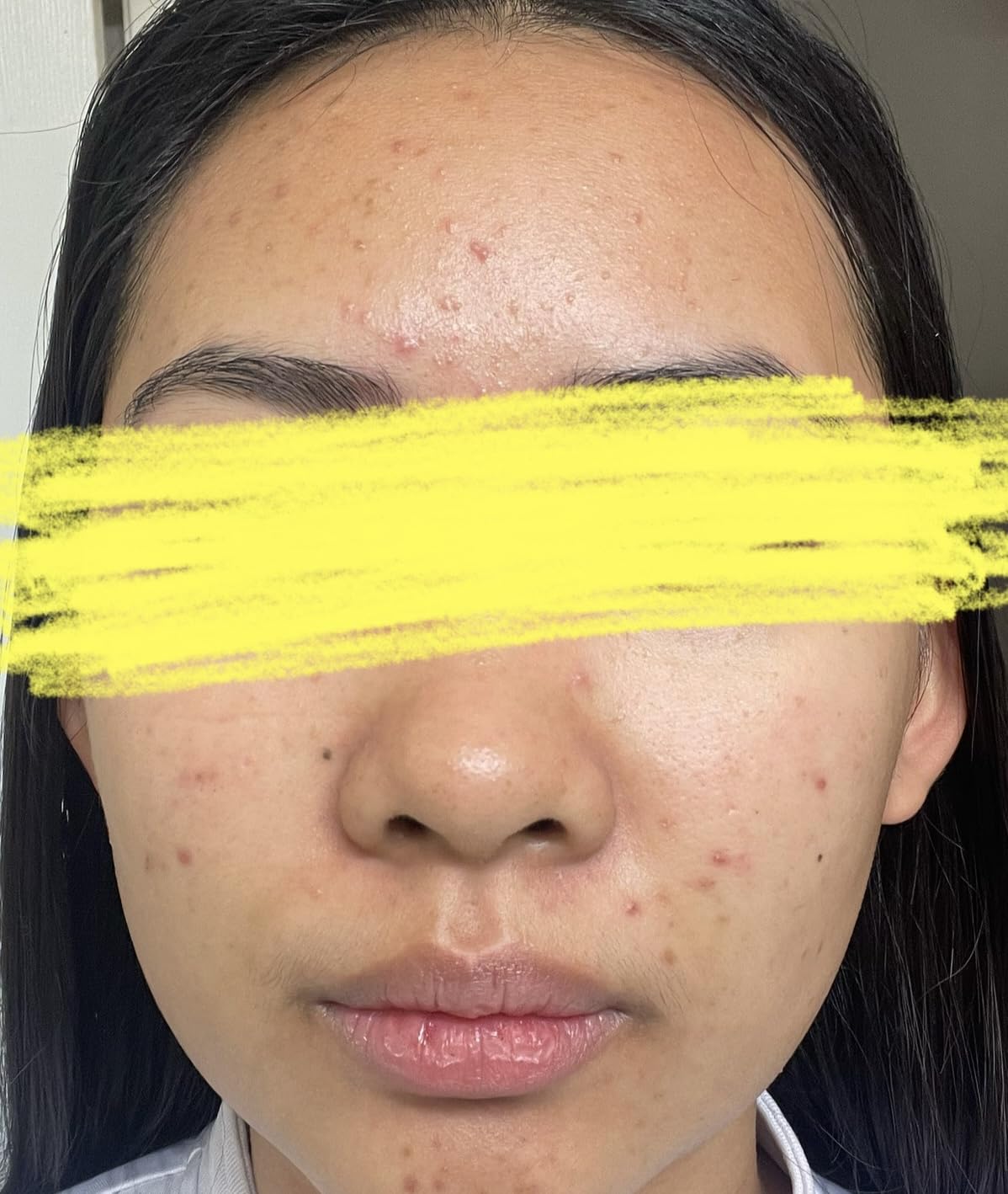 Anua 3-Step Glass Skin Beginner Kit customer photo 2